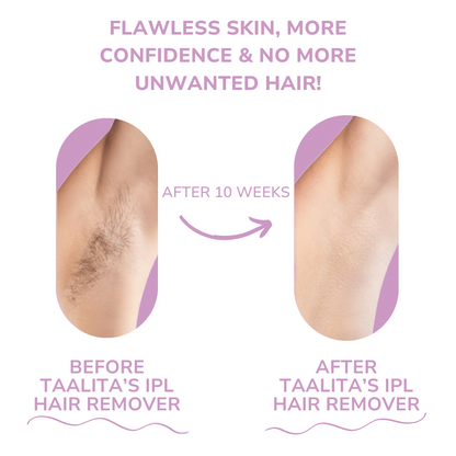 Mini Laser Hair Remover